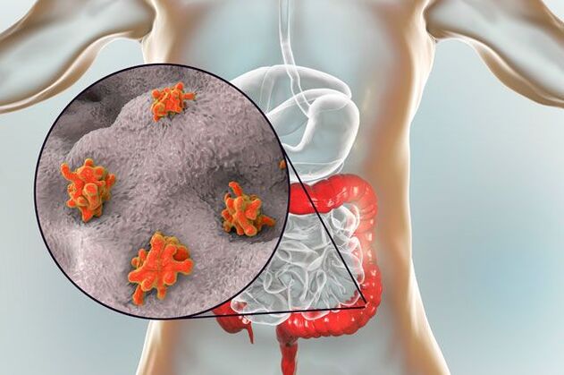 typy parazitů v lidském těle
