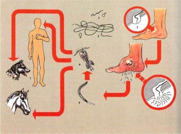 Rozvoj dracunuliázy